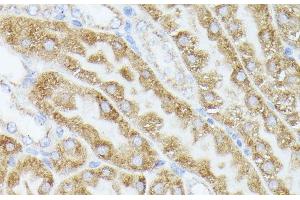 Immunohistochemistry of paraffin-embedded Mouse kidney using ACAT2 Polyclonal Antibody at dilution of 1:100 (40x lens).