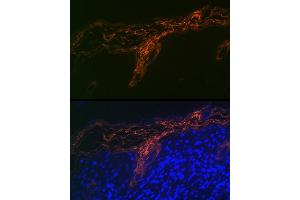Immunofluorescence analysis of human skin cells using PERP Rabbit mAb (ABIN7270861) at dilution of 1:100 (40x lens). (PERP anticorps)
