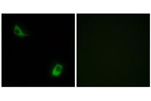 Immunofluorescence analysis of LOVO cells, using FPRL2 antibody.