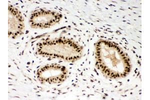 Anti- PBK Picoband antibody, IHC(P) IHC(P): Human Mammary Tissue