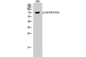 Western Blotting (WB) image for anti-Cell Division Cycle 25 Homolog B (S. Pombe) (CDC25B) (pSer323) antibody (ABIN3181956) (CDC25B anticorps  (pSer323))