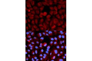 Immunofluorescence (IF) image for anti-Transcription Elongation Factor B (SIII), Polypeptide 2 (18kDa, Elongin B) (TCEB2) antibody (ABIN1876550) (TCEB2 anticorps)