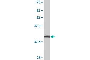 Western Blot detection against Immunogen (38.