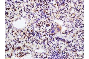 Formalin-fixed and paraffin mouse spleen labeled with Anti-IL-17C Polyclonal Antibody, Unconjugated  at 1:200 followed by conjugation to the secondary antibody and DAB staining.
