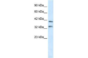 WB Suggested Anti-GSH2 Antibody Titration:  0. (GSX2 anticorps  (N-Term))