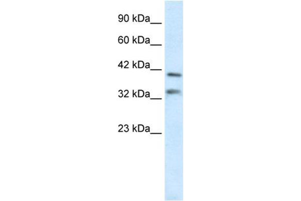 GSX2 anticorps  (N-Term)