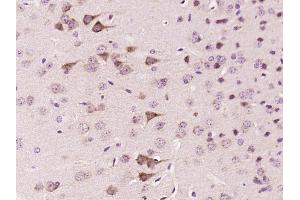 Paraformaldehyde-fixed, paraffin embedded Mouse brain Antigen retrieval by boiling in sodium citrate buffer (pH6.