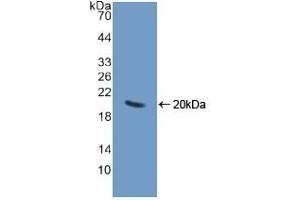 Detection of Recombinant CHGA, Human using Polyclonal Antibody to Chromogranin A (CHGA)