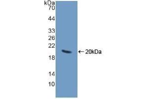 Detection of Recombinant CHGA, Human using Polyclonal Antibody to Chromogranin A (CHGA) (Chromogranin A anticorps  (AA 15-148))