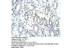 Rabbit Anti-BAG2 Antibody  Paraffin Embedded Tissue: Human Kidney Cellular Data: Epithelial cells of renal tubule Antibody Concentration: 4. (BAG2 anticorps  (C-Term))
