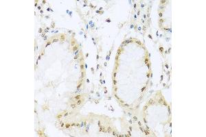 Immunohistochemistry of paraffin-embedded human stomach using PGR antibody at dilution of 1:100 (x40 lens). (Progesterone Receptor anticorps)