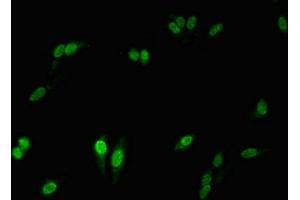 Immunofluorescent analysis of Hela cells using ABIN7161498 at dilution of 1:100 and Alexa Fluor 488-congugated AffiniPure Goat Anti-Rabbit IgG(H+L)