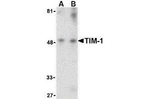 Western Blotting (WB) image for anti-Hepatitis A Virus Cellular Receptor 1 (HAVCR1) (Center) antibody (ABIN2476808) (HAVCR1 anticorps  (Center))