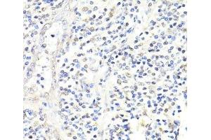 Immunohistochemistry of paraffin-embedded Human appendix using FKBP5 Polyclonal Antibody at dilution of 1:100 (40x lens). (FKBP5 anticorps)
