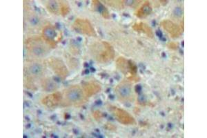 Used in DAB staining on fromalin fixed paraffin-embedded Liver tissue (FGF23 anticorps  (AA 25-251))