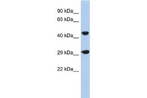 WB Suggested Anti-C22orf25 Antibody Titration: 0. (C22orf25 anticorps  (N-Term))
