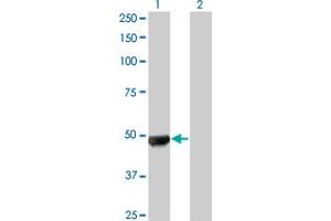 Western Blot analysis of UBR2 expression in transfected 293T cell line by UBR2 monoclonal antibody (M01A), clone 4G4.