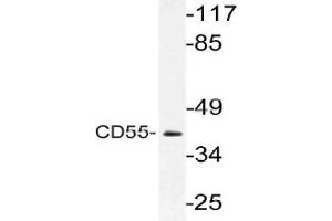 Western blot (WB) analysis of CD55 antibody in extracts from Jurkat cells. (CD55 anticorps)