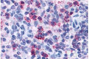 Anti-P2RY4 / P2Y4 antibody  ABIN1049218 IHC staining of human spleen.