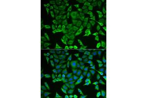 Immunofluorescence analysis of MCF-7 cells using RARS antibody (ABIN6127449, ABIN6146708, ABIN6146709 and ABIN6221913). (RARS anticorps  (AA 1-300))