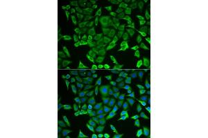 anti-Arginyl-tRNA Synthetase (RARS) (AA 1-300) antibody