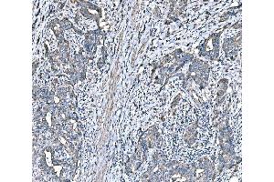 IHC analysis of HSPA6 using anti-HSPA6 antibody (ABIN7601944). (HSPA6 anticorps  (AA 516-643))