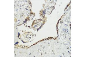 Immunohistochemistry of paraffin-embedded human placenta using H antibody (ABIN7267593) at dilution of 1:100 (40x lens). (HACE1 anticorps  (AA 1-100))