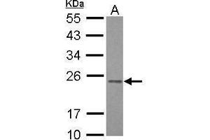 WB Image Sample (30 ug of whole cell lysate) A: HepG2 12% SDS PAGE antibody diluted at 1:1000 (RAB3B anticorps)