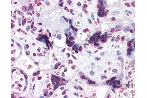 Anti-CARD14 / CARMA2 antibody IHC of human placenta. (CARD14 anticorps  (C-Term))