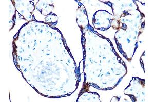 Immunohistochemistry of paraffin-embedded human placenta using Cytokeratin 7 (KRT7) (KRT7) Rabbit mAb  at dilution of 1:100 (40x lens). (Cytokeratin 7 anticorps)
