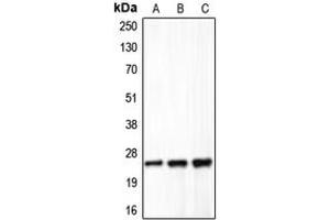 Western blot analysis of Claudin 5 expression in HeLa (A), mouse liver (B), rat lung (C) whole cell lysates. (Claudin 5 anticorps  (C-Term))