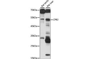 Western blot analysis of extracts of various cell lines, using CPB2 antibody (ABIN7266081) at 1:1000 dilution. (CPB2 anticorps  (AA 310-410))