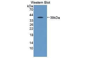 Western blot analysis of the recombinant protein. (CCL19 anticorps  (AA 159-258))