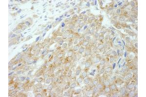Immunohistochemistry (IHC) image for anti-Flightless I Homolog (FLII) (AA 425-475) antibody (ABIN7448968)