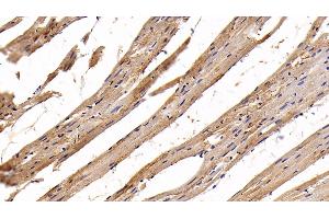 Detection of AST2 in Rat Cardiac Muscle Tissue using Polyclonal Antibody to Aspartate Aminotransferase 2 (AST2) (GOT2 anticorps  (AA 30-430))