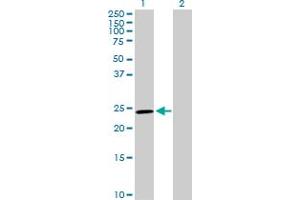 Western Blot analysis of GSTM5 expression in transfected 293T cell line by GSTM5 MaxPab polyclonal antibody. (GSTM5 anticorps  (AA 1-218))