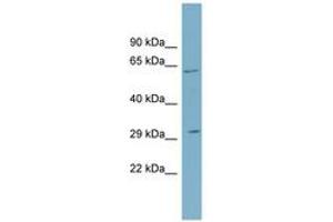 Image no. 1 for anti-Steroid-5-alpha-Reductase, alpha Polypeptide 2 (3-Oxo-5 alpha-Steroid delta 4-Dehydrogenase alpha 2) (SRD5A2) (N-Term) antibody (ABIN6743291) (SRD5A2 anticorps  (N-Term))