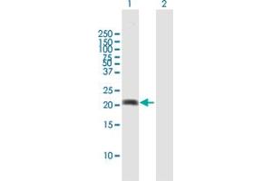 Western Blot analysis of MPHOSPH6 expression in transfected 293T cell line by MPHOSPH6 MaxPab polyclonal antibody.