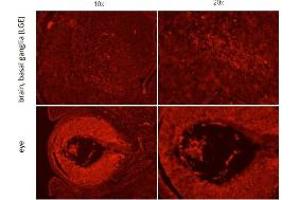 Immunohistochemistry of Rabbit anti-Six-3 antibody Immunohistochemistry of Rabbit anti-Six-3 antibody. (SIX3 anticorps  (Internal Region))