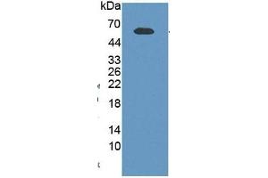 WB of Protein Standard: different control antibodies against Highly purified E. (NAMPT Kit ELISA)