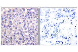 Immunohistochemistry (IHC) image for anti-Transforming Growth Factor, beta 3 (TGFB3) (Internal Region) antibody (ABIN1848799) (TGFB3 anticorps  (Internal Region))