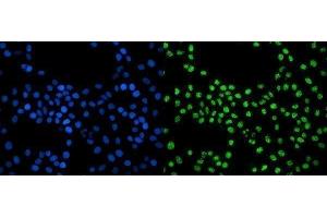 IF analysis of EXOSC3 using anti-EXOSC3 antibody (ABIN7602216).