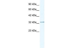 NUDT9 antibody used at 1. (NUDT9 anticorps)