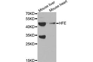 Western blot analysis of extracts of various cell lines, using HFE antibody. (HFE anticorps)