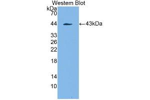 Western blot analysis of the recombinant protein. (PDGFRL anticorps  (AA 22-375))