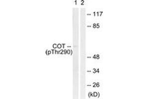 Western blot analysis of extracts from 293 cells treated with UV 15', using COT (Phospho-Thr290) Antibody.