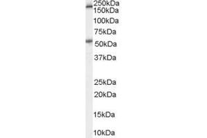 Western Blotting (WB) image for anti-Serotonin Receptor 3A (HTR3A) (Internal Region) antibody (ABIN2466257) (Serotonin Receptor 3A anticorps  (Internal Region))