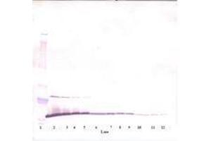 Image no. 2 for anti-Melanoma Inhibitory Activity (MIA) antibody (ABIN464851) (MIA anticorps)