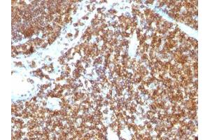 Image no. 1 for anti-CD45RB (CD45RB) antibody (ABIN6170687) (CD45RB anticorps)