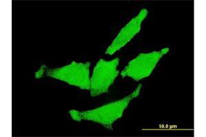 Immunofluorescence of monoclonal antibody to ERBB2 on HeLa cell.